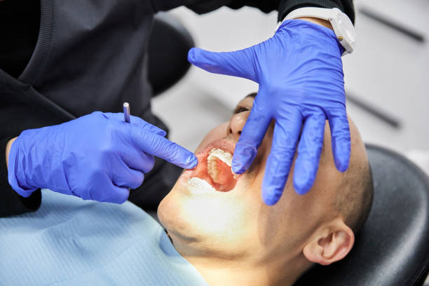Best Emergency Dental Extractions in Abingdon, VA